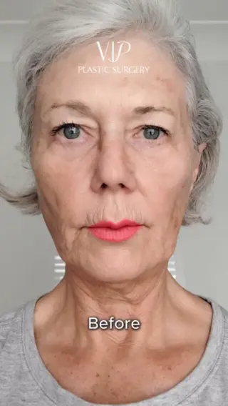 Beauty Image 1