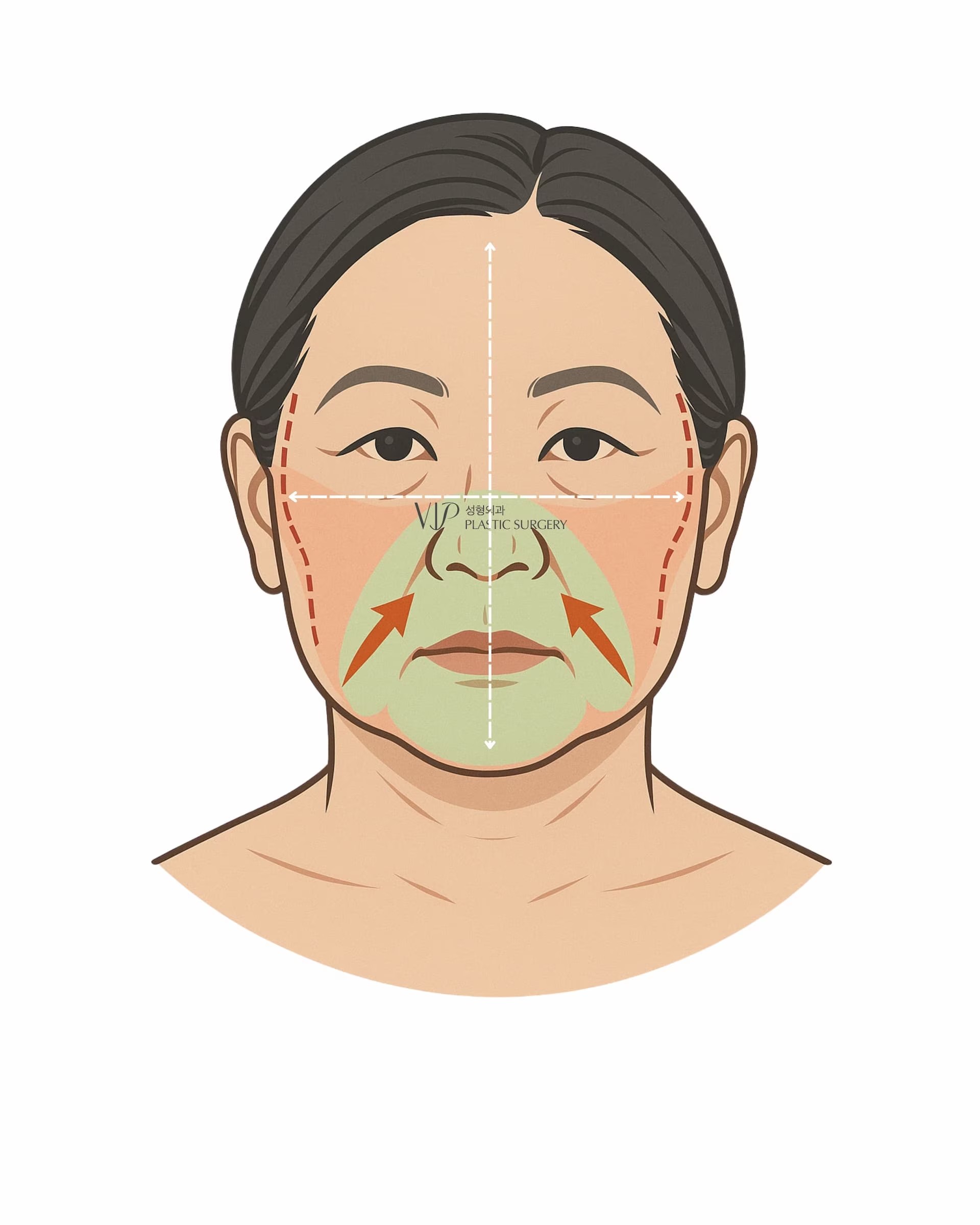 VIP Plastic Surgery