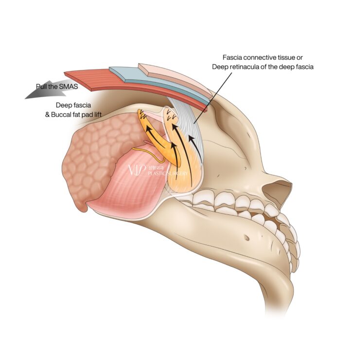 Facial anatomy SMAS layer
