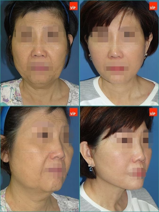 2nd Case Study