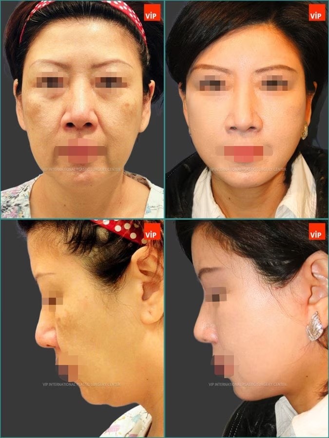 3rd Case Study