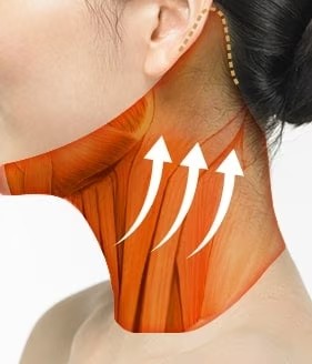 Neck Lift Step 02
