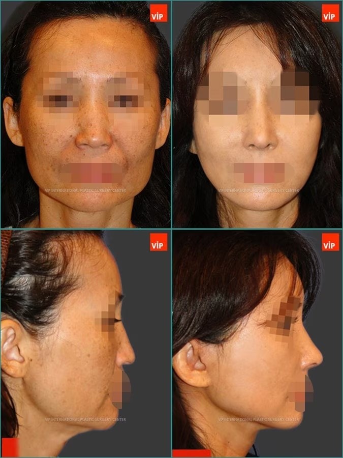 1st Case Study