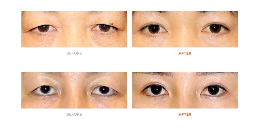 Before & After